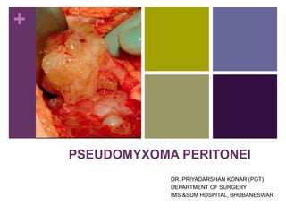 +
PSEUDOMYXOMA PERITONEI
DR. PRIYADARSHAN KONAR (PGT)
DEPARTMENT OF SURGERY
IMS &SUM HOSPITAL, BHUBANESWAR
 