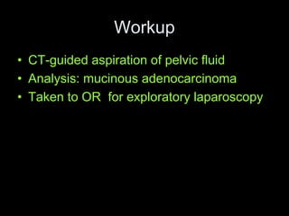 Workup
• CT-guided aspiration of pelvic fluid
• Analysis: mucinous adenocarcinoma
• Taken to OR for exploratory laparoscopy
 