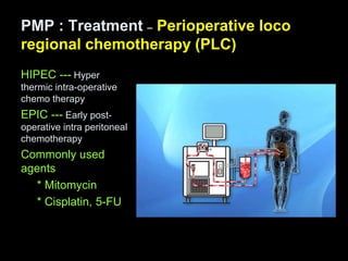 PMP : Treatment – Perioperative loco
regional chemotherapy (PLC)
HIPEC --- Hyper
thermic intra-operative
chemo therapy
EPIC --- Early post-
operative intra peritoneal
chemotherapy
Commonly used
agents
* Mitomycin
* Cisplatin, 5-FU
 