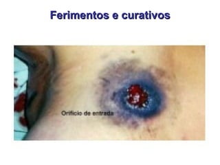 Ferimentos e curativos 