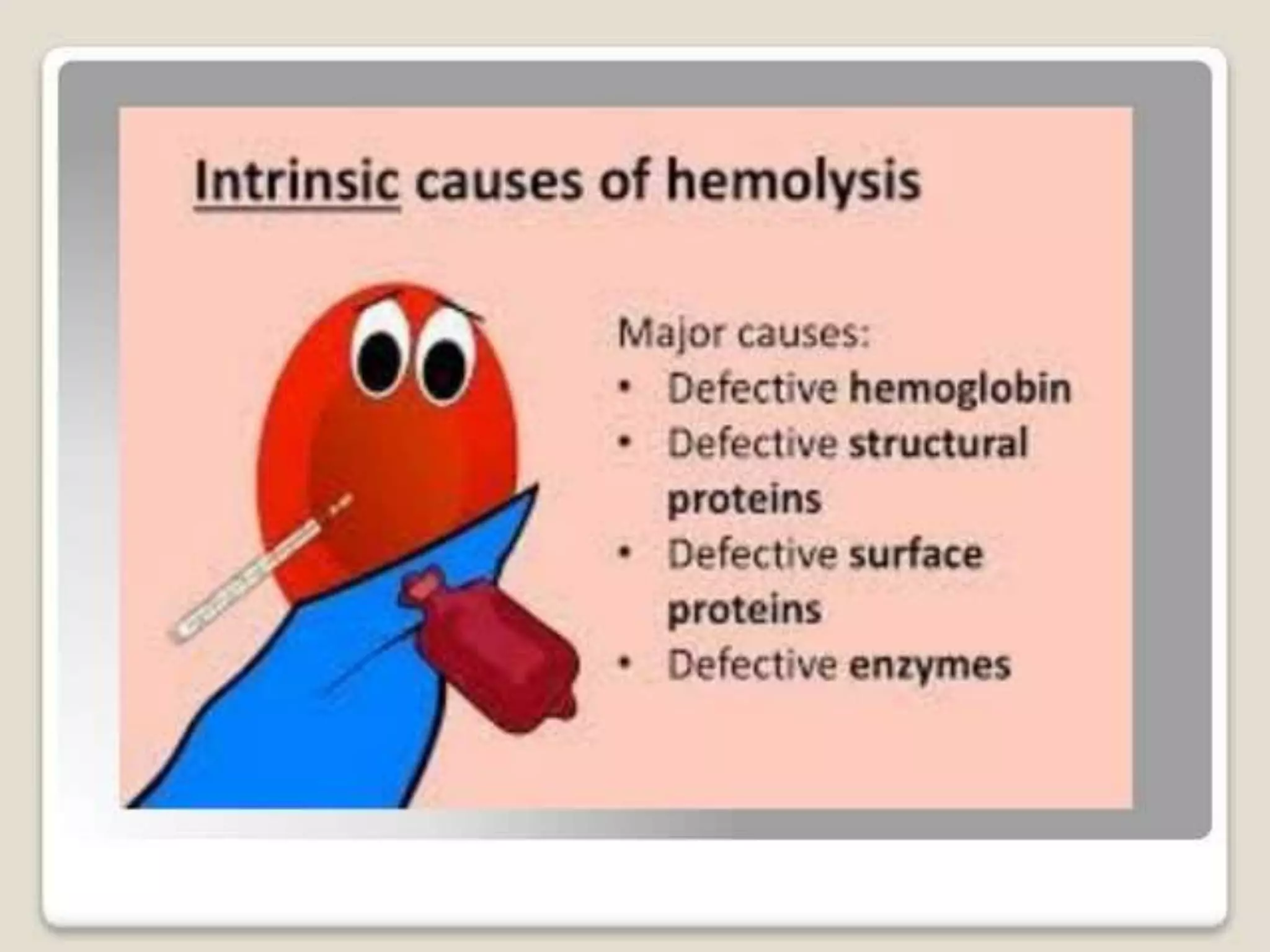 PS Findings In Hemolytic Anemia.pptx