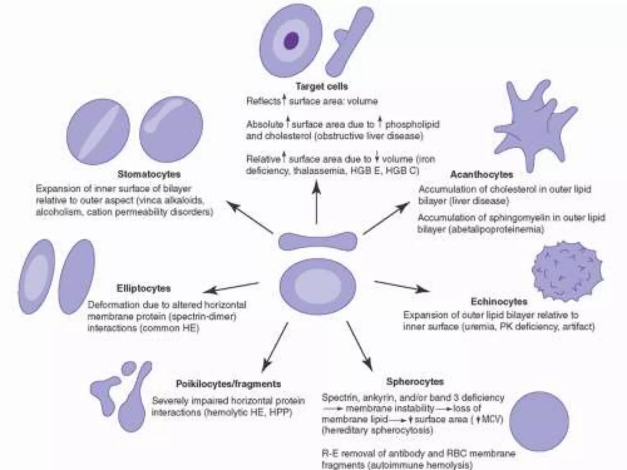 PS Findings In Hemolytic Anemia.pptx