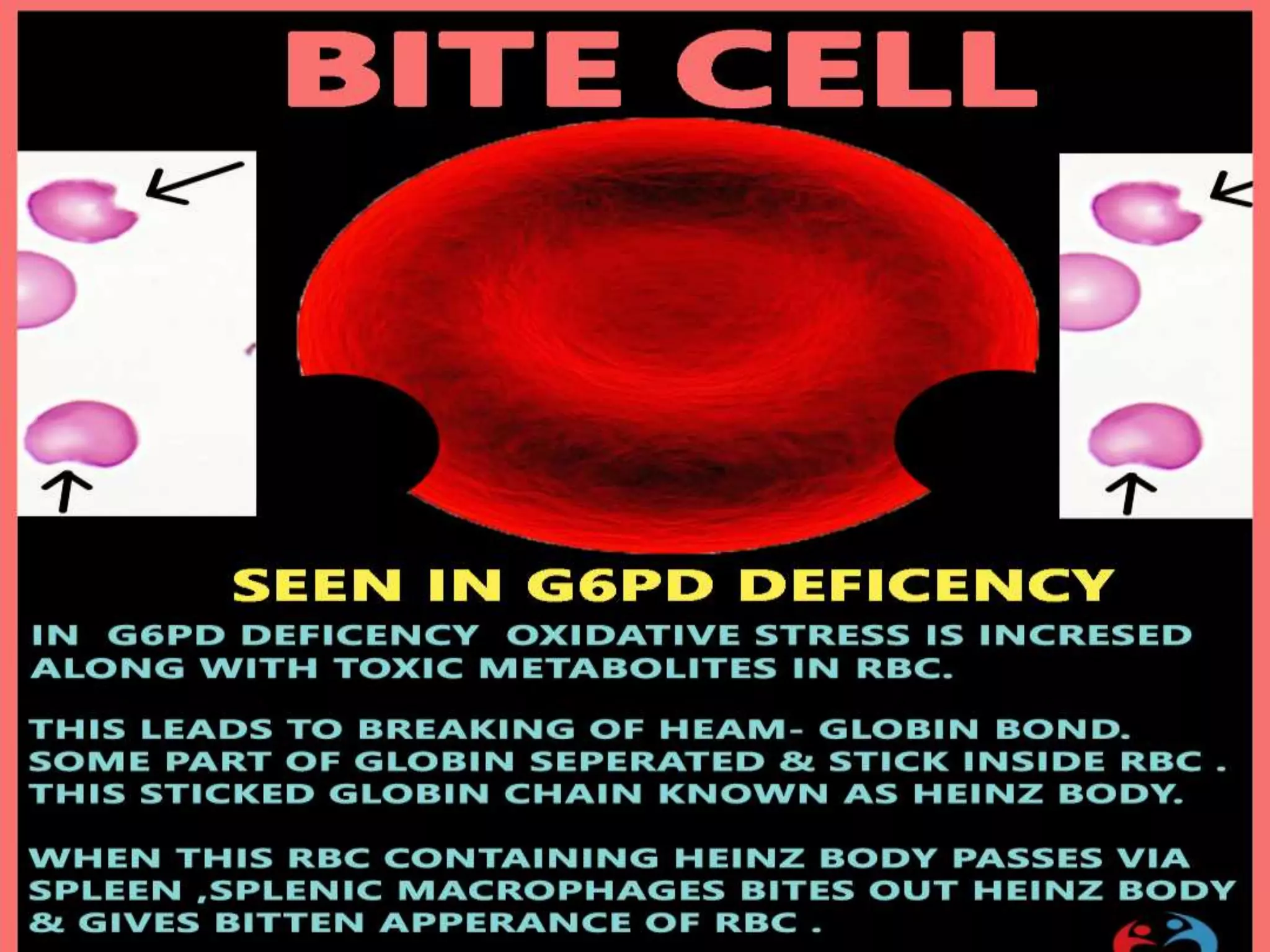 PS Findings In Hemolytic Anemia.pptx