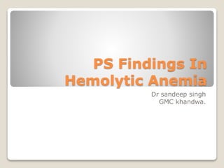 PS Findings In
Hemolytic Anemia
Dr sandeep singh
GMC khandwa.
 