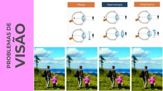 PROBLEMAS
DE
VISÃO
 