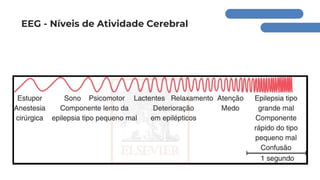 EEG - Níveis de Atividade Cerebral
 