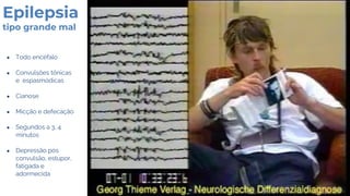 Epilepsia
tipo grande mal
● Todo encéfalo
● Convulsões tônicas
e espasmódicas
● Cianose
● Micção e defecação
● Segundos a 3, 4
minutos
● Depressão pós
convulsão, estupor,
fatigada e
adormecida
 