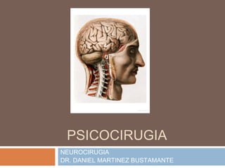 PSICOCIRUGIA
NEUROCIRUGIA
DR. DANIEL MARTINEZ BUSTAMANTE
 