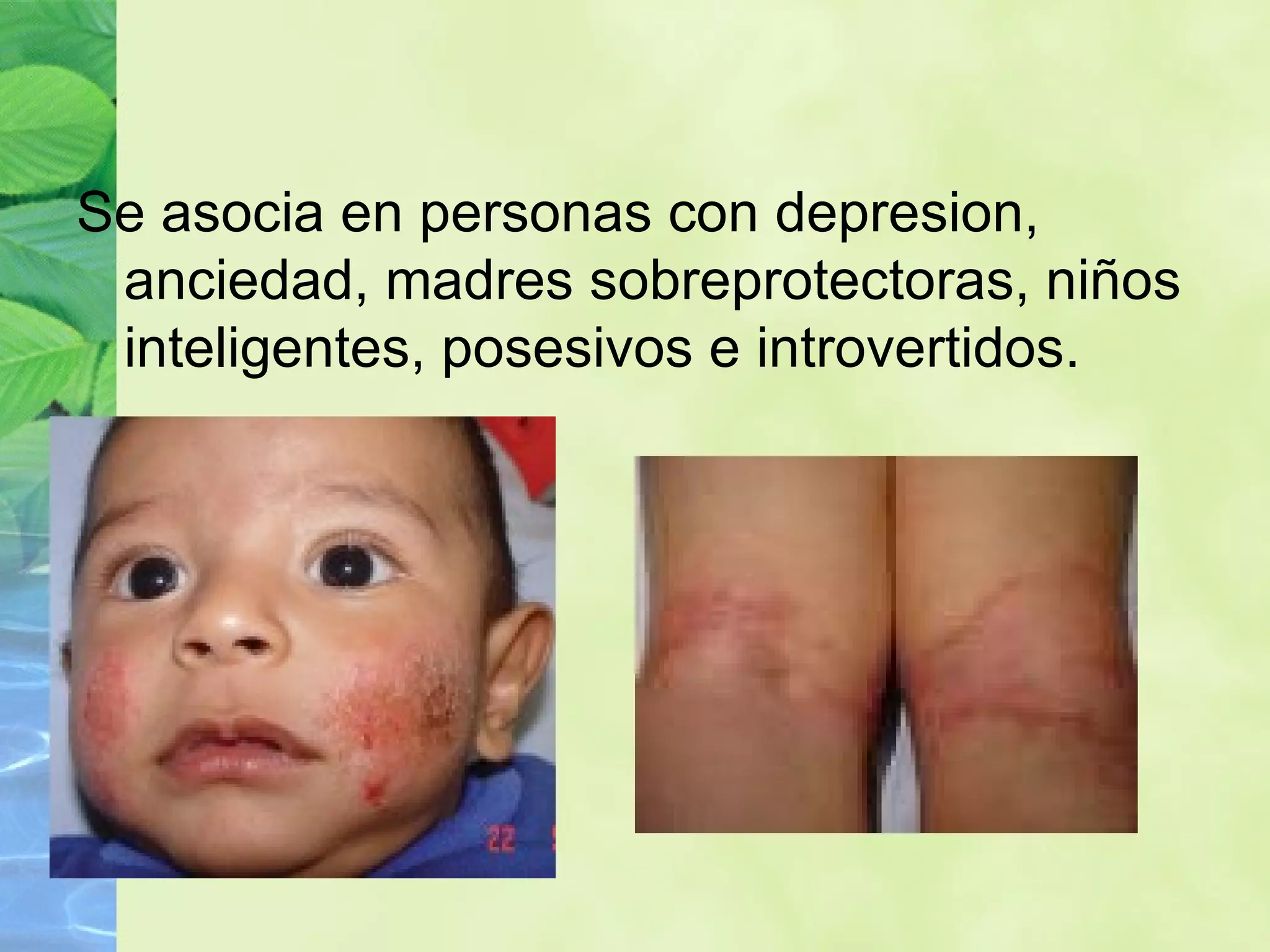 Se asocia en personas con depresion, anciedad, madres sobreprotectoras, niños inteligentes, posesivos e introvertidos. 