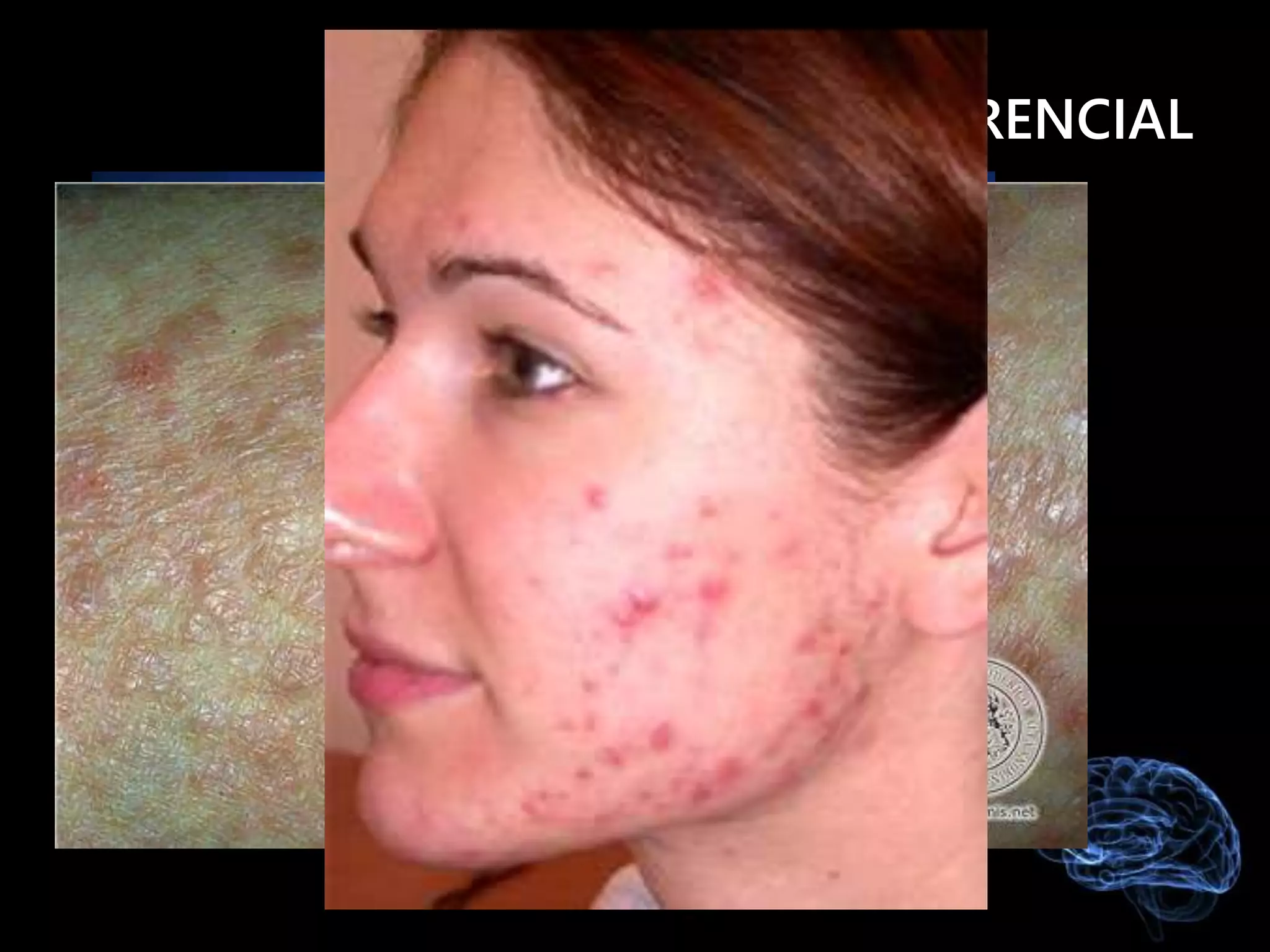 DIAGNÓSTICO DIFERENCIAL
 