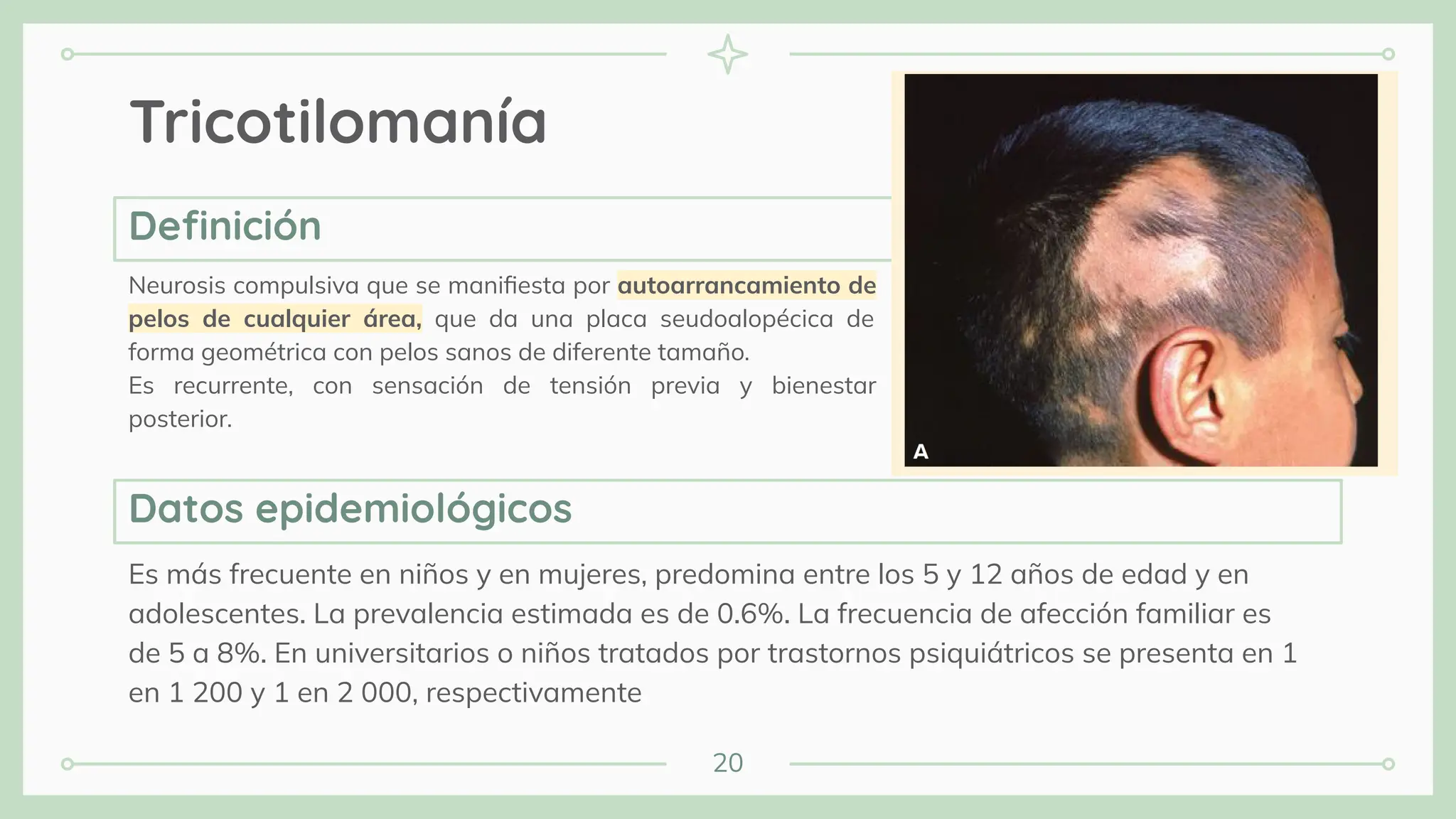 20
Tricotilomanía
Neurosis compulsiva que se maniﬁesta por autoarrancamiento de
pelos de cualquier área, que da una placa seudoalopécica de
forma geométrica con pelos sanos de diferente tamaño.
Es recurrente, con sensación de tensión previa y bienestar
posterior.
Es más frecuente en niños y en mujeres, predomina entre los 5 y 12 años de edad y en
adolescentes. La prevalencia estimada es de 0.6%. La frecuencia de afección familiar es
de 5 a 8%. En universitarios o niños tratados por trastornos psiquiátricos se presenta en 1
en 1 200 y 1 en 2 000, respectivamente
Deﬁnición
Datos epidemiológicos
 