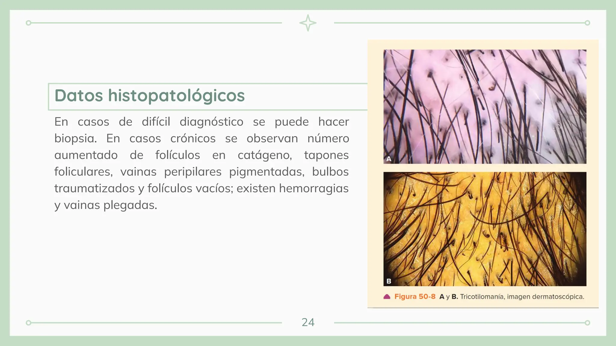 24
En casos de difícil diagnóstico se puede hacer
biopsia. En casos crónicos se observan número
aumentado de folículos en catágeno, tapones
foliculares, vainas peripilares pigmentadas, bulbos
traumatizados y folículos vacíos; existen hemorragias
y vainas plegadas.
Datos histopatológicos
 
