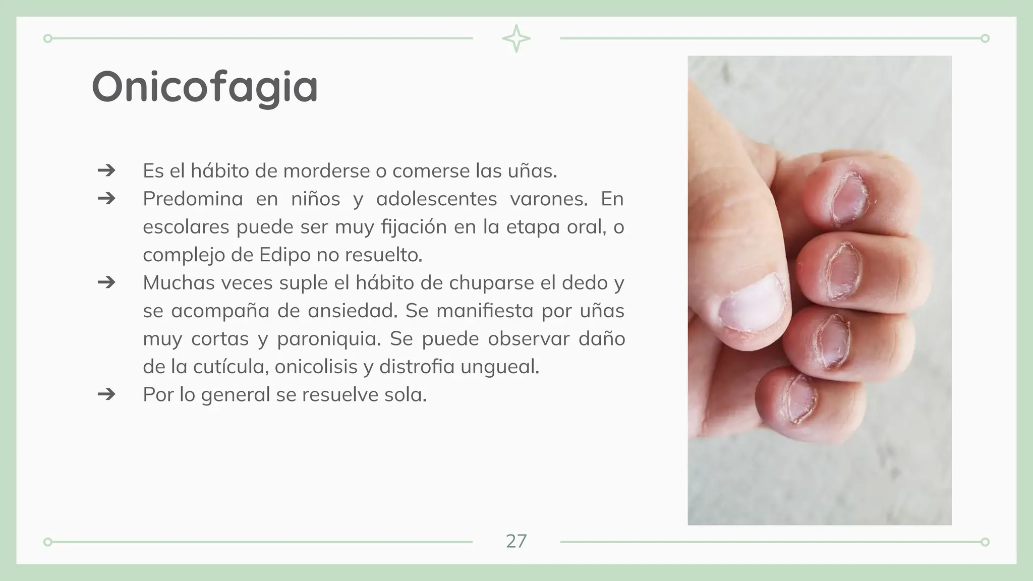 27
Onicofagia
➔ Es el hábito de morderse o comerse las uñas.
➔ Predomina en niños y adolescentes varones. En
escolares puede ser muy ﬁjación en la etapa oral, o
complejo de Edipo no resuelto.
➔ Muchas veces suple el hábito de chuparse el dedo y
se acompaña de ansiedad. Se maniﬁesta por uñas
muy cortas y paroniquia. Se puede observar daño
de la cutícula, onicolisis y distroﬁa ungueal.
➔ Por lo general se resuelve sola.
 