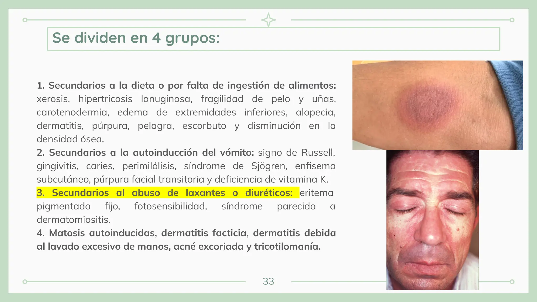 33
1. Secundarios a la dieta o por falta de ingestión de alimentos:
xerosis, hipertricosis lanuginosa, fragilidad de pelo y uñas,
carotenodermia, edema de extremidades inferiores, alopecia,
dermatitis, púrpura, pelagra, escorbuto y disminución en la
densidad ósea.
2. Secundarios a la autoinducción del vómito: signo de Russell,
gingivitis, caries, perimilólisis, síndrome de Sjögren, enﬁsema
subcutáneo, púrpura facial transitoria y deﬁciencia de vitamina K.
3. Secundarios al abuso de laxantes o diuréticos: eritema
pigmentado ﬁjo, fotosensibilidad, síndrome parecido a
dermatomiositis.
4. Matosis autoinducidas, dermatitis facticia, dermatitis debida
al lavado excesivo de manos, acné excoriada y tricotilomanía.
Se dividen en 4 grupos:
 