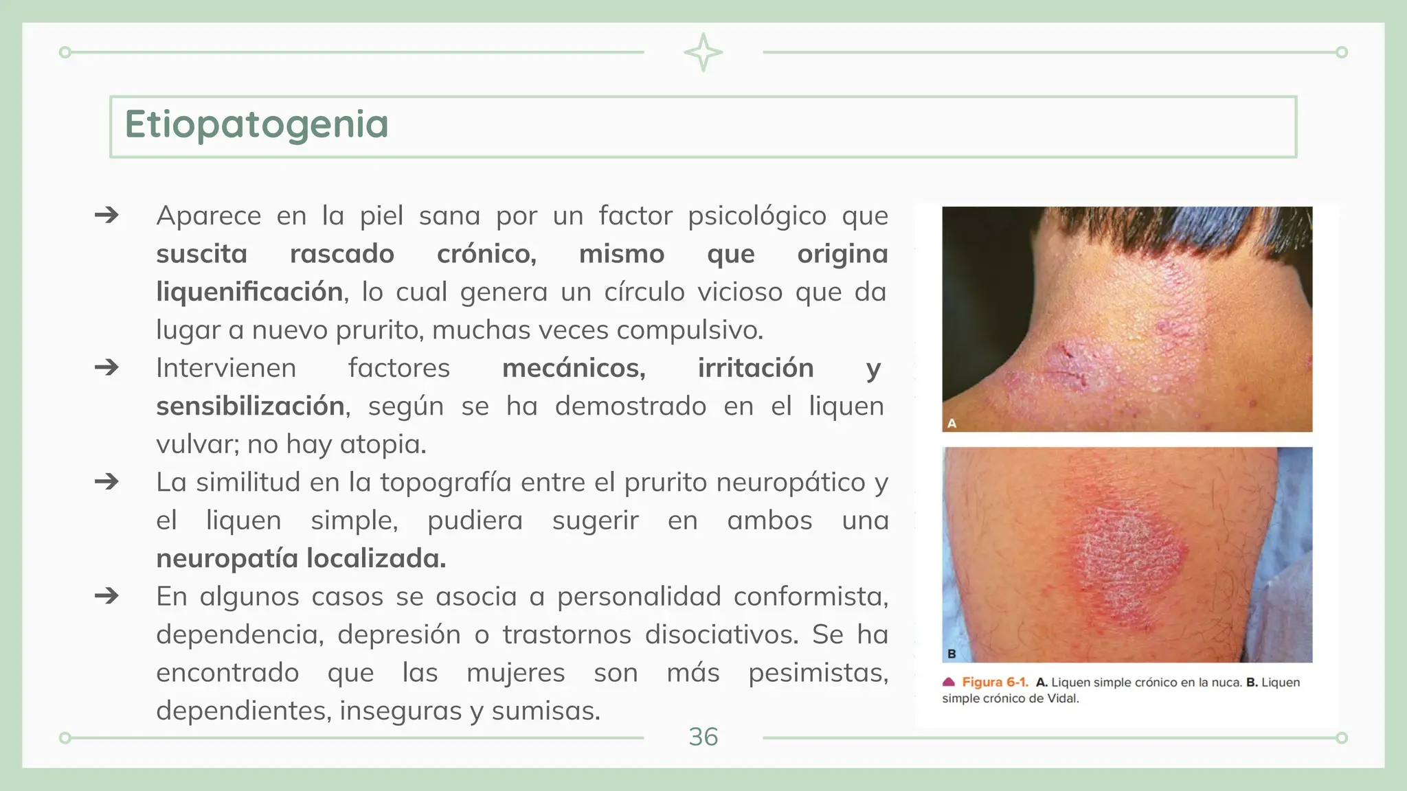 36
➔ Aparece en la piel sana por un factor psicológico que
suscita rascado crónico, mismo que origina
liqueniﬁcación, lo cual genera un círculo vicioso que da
lugar a nuevo prurito, muchas veces compulsivo.
➔ Intervienen factores mecánicos, irritación y
sensibilización, según se ha demostrado en el liquen
vulvar; no hay atopia.
➔ La similitud en la topografía entre el prurito neuropático y
el liquen simple, pudiera sugerir en ambos una
neuropatía localizada.
➔ En algunos casos se asocia a personalidad conformista,
dependencia, depresión o trastornos disociativos. Se ha
encontrado que las mujeres son más pesimistas,
dependientes, inseguras y sumisas.
Etiopatogenia
 