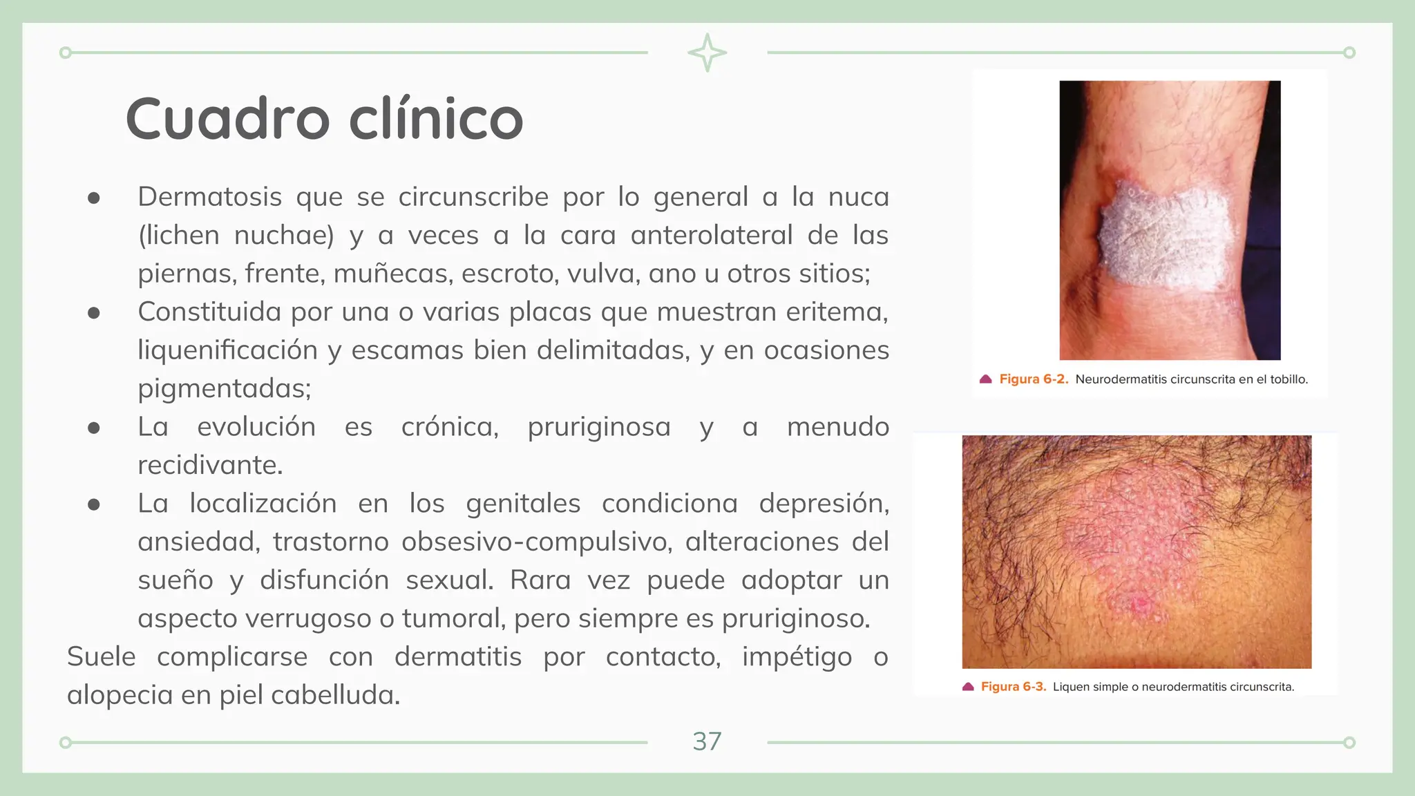 37
Cuadro clínico
● Dermatosis que se circunscribe por lo general a la nuca
(lichen nuchae) y a veces a la cara anterolateral de las
piernas, frente, muñecas, escroto, vulva, ano u otros sitios;
● Constituida por una o varias placas que muestran eritema,
liqueniﬁcación y escamas bien delimitadas, y en ocasiones
pigmentadas;
● La evolución es crónica, pruriginosa y a menudo
recidivante.
● La localización en los genitales condiciona depresión,
ansiedad, trastorno obsesivo-compulsivo, alteraciones del
sueño y disfunción sexual. Rara vez puede adoptar un
aspecto verrugoso o tumoral, pero siempre es pruriginoso.
Suele complicarse con dermatitis por contacto, impétigo o
alopecia en piel cabelluda.
 