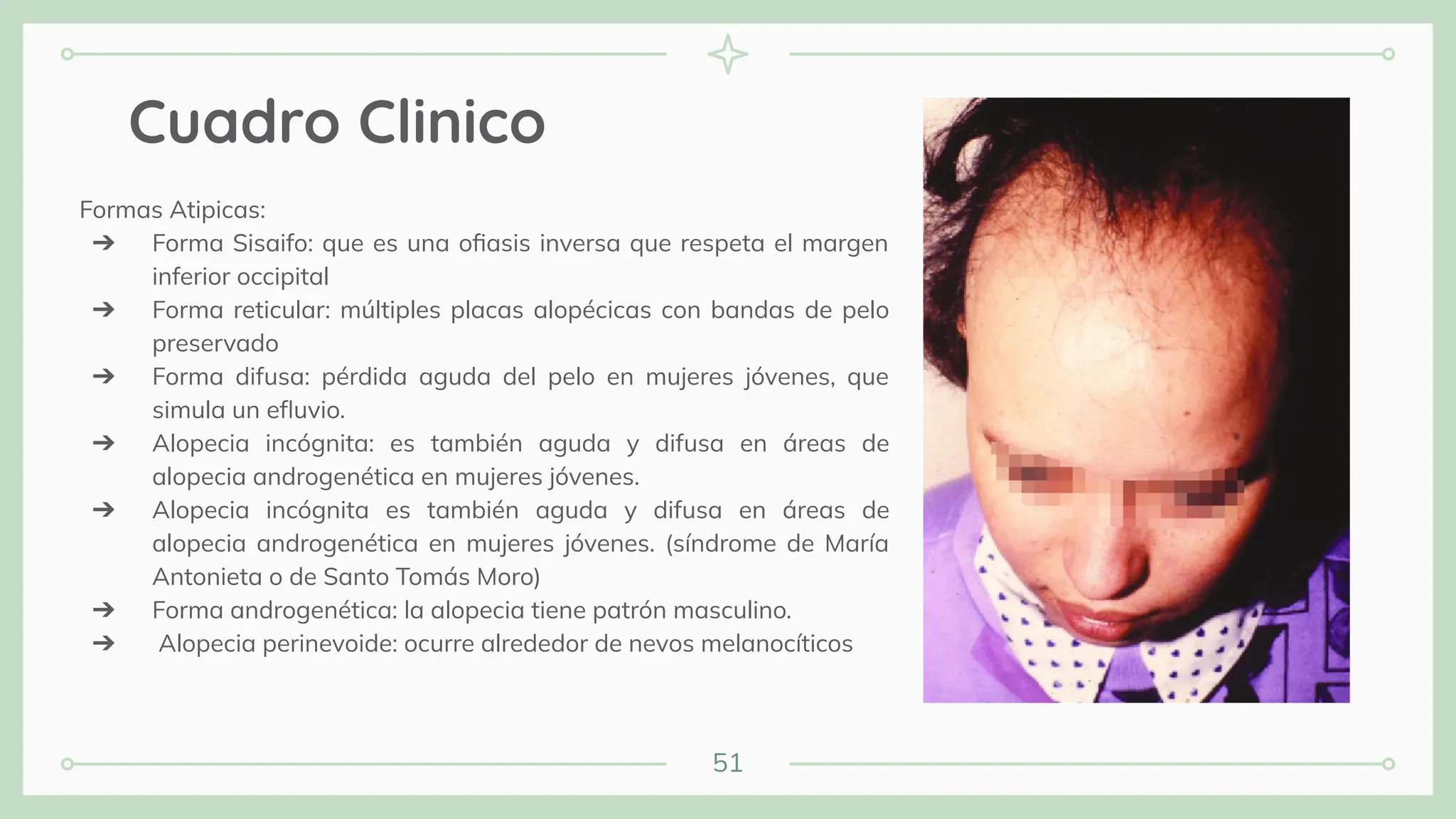 51
Cuadro Clinico
Formas Atipicas:
➔ Forma Sisaifo: que es una oﬁasis inversa que respeta el margen
inferior occipital
➔ Forma reticular: múltiples placas alopécicas con bandas de pelo
preservado
➔ Forma difusa: pérdida aguda del pelo en mujeres jóvenes, que
simula un eﬂuvio.
➔ Alopecia incógnita: es también aguda y difusa en áreas de
alopecia androgenética en mujeres jóvenes.
➔ Alopecia incógnita es también aguda y difusa en áreas de
alopecia androgenética en mujeres jóvenes. (síndrome de María
Antonieta o de Santo Tomás Moro)
➔ Forma androgenética: la alopecia tiene patrón masculino.
➔ Alopecia perinevoide: ocurre alrededor de nevos melanocíticos
 