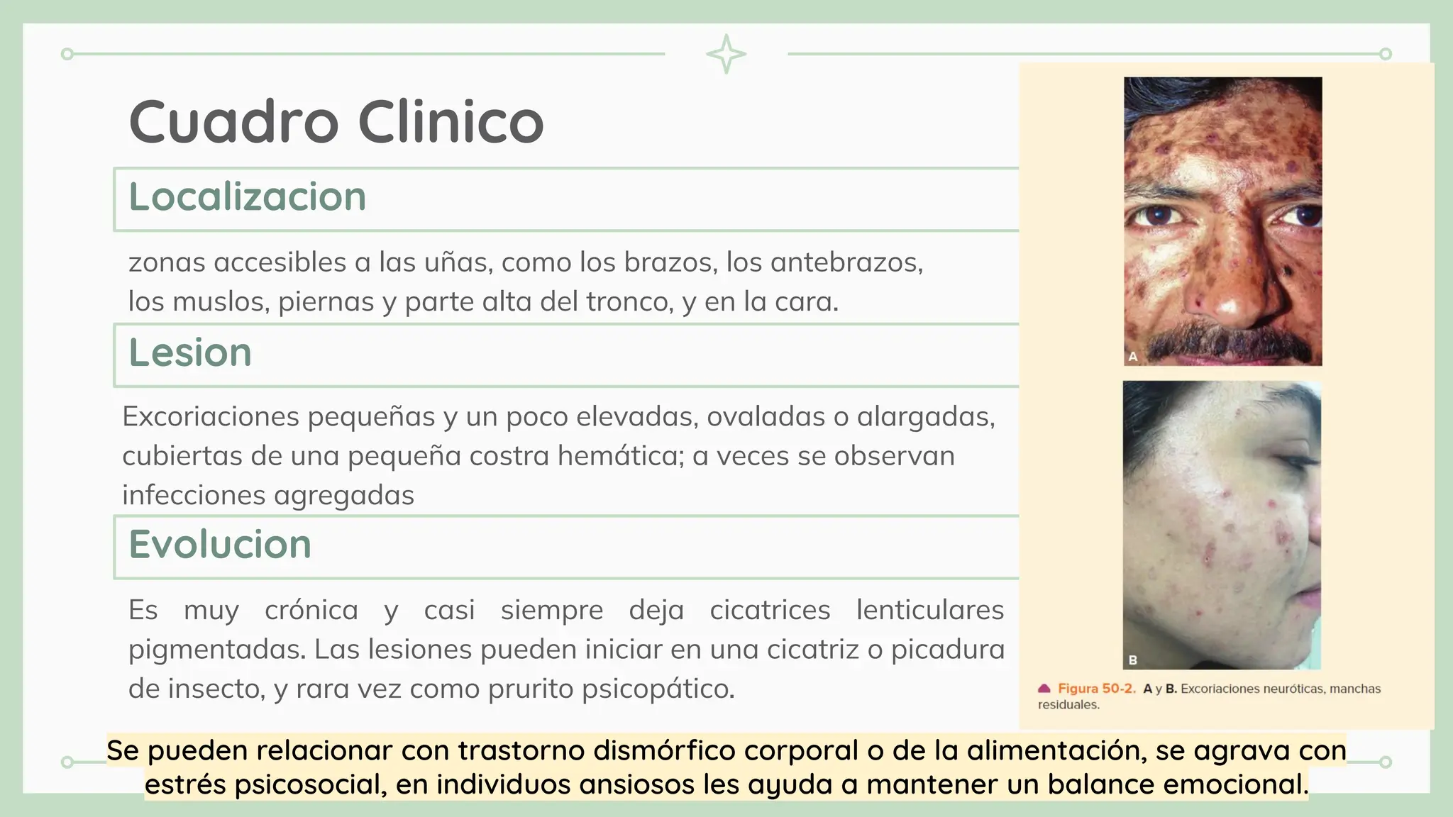 Cuadro Clinico
zonas accesibles a las uñas, como los brazos, los antebrazos,
los muslos, piernas y parte alta del tronco, y en la cara.
Excoriaciones pequeñas y un poco elevadas, ovaladas o alargadas,
cubiertas de una pequeña costra hemática; a veces se observan
infecciones agregadas
Es muy crónica y casi siempre deja cicatrices lenticulares
pigmentadas. Las lesiones pueden iniciar en una cicatriz o picadura
de insecto, y rara vez como prurito psicopático.
Localizacion
Lesion
Evolucion
Se pueden relacionar con trastorno dismórﬁco corporal o de la alimentación, se agrava con
estrés psicosocial, en individuos ansiosos les ayuda a mantener un balance emocional.
 