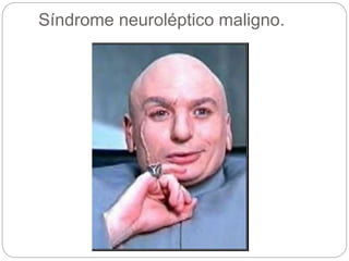 Síndrome neuroléptico maligno.
 