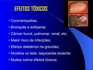 •  Coronariopatias; •  Bronquite e enfisema; •  Câncer bucal, pulmonar, renal, etc; •  Maior risco de infecções; •  Efeitos deletérios na gravidez; •  Nicotina no leite: taquicardia lactente; •  Muitos outros efeitos tóxicos. EFEITOS TÓXICOS 