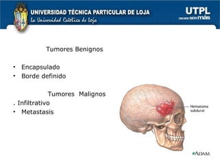 Tumores Benignos Encapsulado  Borde definido Tumores  Malignos . Infiltrativo Metastasis 