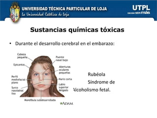 Sustancias químicas tóxicas Durante el desarrollo cerebral en el embarazo: Rubéola  Síndrome de  Alcoholismo fetal. 