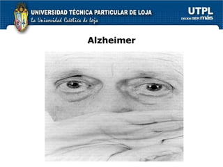 Alzheimer 