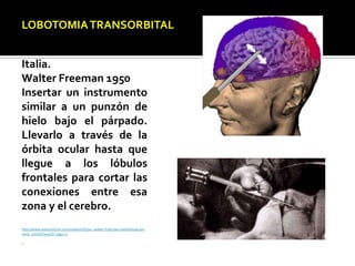 LOBOTOMIATRANSORBITAL
Italia.
Walter Freeman 1950
Insertar un instrumento
similar a un punzón de
hielo bajo el párpado.
Llevarlo a través de la
órbita ocular hasta que
llegue a los lóbulos
frontales para cortar las
conexiones entre esa
zona y el cerebro.
http://www.dailymotion.com/video/x7fz9w_walter-freeman-lobotomias-en-
serie_school?search_algo=2
--
 