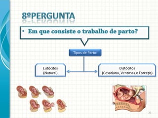 Tipos de Parto:


Eutócitos                                Distócitos
(Natural)                     (Cesariana, Ventosas e Forceps)




                                                          20
 