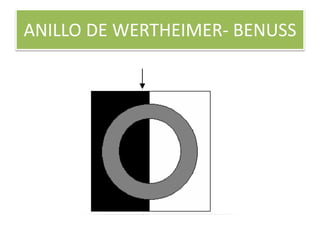 ANILLO DE WERTHEIMER- BENUSS
 