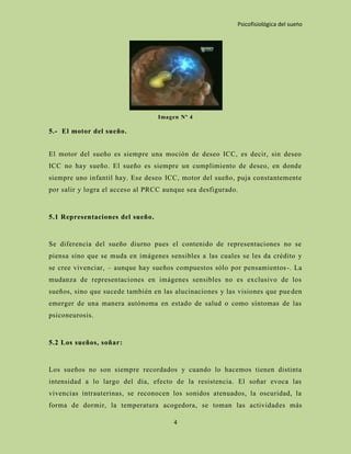 Psicofisiológica del sueño




                                  Imagen Nº 4

5.- El motor del sueño.


El motor del sueño es siempre una moción de deseo ICC, es decir, sin deseo
ICC no hay sueño. El sueño es siempre un cumplimiento de deseo, en donde
siempre uno infantil hay. Ese deseo ICC, motor del sueño, puja constantemente
por salir y logra el acceso al PRCC aunque sea desfigurado.


5.1 Representaciones del sueño.


Se diferencia del sueño diurno pues el contenido de representaciones no se
piensa sino que se muda en imágenes sensibles a las cuales se les da crédito y
se cree vivenciar, – aunque hay sueños compuestos sólo por pensamientos -. La
mudanza de representaciones en imágenes sensibles no es exclusivo de los
sueños, sino que sucede también en las alucinaciones y las visiones que pue den
emerger de una manera autónoma en estado de salud o como síntomas de las
psiconeurosis.


5.2 Los sueños, soñar:


Los sueños no son siempre recordados y cuando lo hacemos tienen distinta
intensidad a lo largo del día, efecto de la resistencia. El soñar evoca las
vivencias intrauterinas, se reconocen los sonidos atenuados, la oscuridad, la
forma de dormir, la temperatura acogedora, se toman las actividades más

                                       4
 