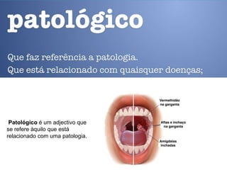 Patológico é um adjectivo que
se refere àquilo que está
relacionado com uma patologia.
 