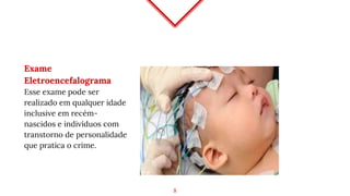 Exame
Eletroencefalograma
Esse exame pode ser
realizado em qualquer idade
inclusive em recém-
nascidos e indivíduos com
transtorno de personalidade
que pratica o crime.
8
 