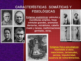 Estigmas anatómicos: pómulos y
mandíbulas amplios, fosas
orbitales grandes, anomalías
dentarias, estrabismo, cabello
risado y lanoso, malformaciones
genitales, otros.
Estigmas físico psicológicos:
Insensible al dolor,
mancinismo, tartamudez,
pereza, impulsividad,
ausencia de remordimientos.
 