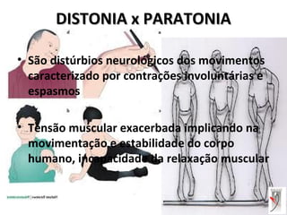 DISTONIA x PARATONIADISTONIA x PARATONIA
• São distúrbios neurológicos dos movimentos
caracterizado por contrações involuntárias e
espasmos
• Tensão muscular exacerbada implicando na
movimentação e estabilidade do corpo
humano, incapacidade da relaxação muscular
 