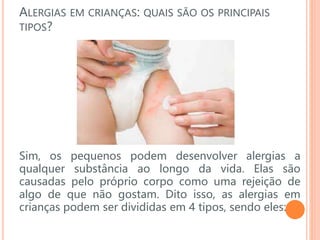 ALERGIAS EM CRIANÇAS: QUAIS SÃO OS PRINCIPAIS
TIPOS?
Sim, os pequenos podem desenvolver alergias a
qualquer substância ao longo da vida. Elas são
causadas pelo próprio corpo como uma rejeição de
algo de que não gostam. Dito isso, as alergias em
crianças podem ser divididas em 4 tipos, sendo eles:
 