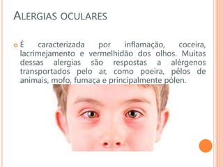 ALERGIAS OCULARES
 É caracterizada por inflamação, coceira,
lacrimejamento e vermelhidão dos olhos. Muitas
dessas alergias são respostas a alérgenos
transportados pelo ar, como poeira, pêlos de
animais, mofo, fumaça e principalmente pólen.
 