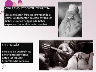 LOBOTOMÍA
consiste en destruir las
conexiones nerviosas
entre los lóbulos
frontales del cerebro.
COMA INDUCIDO POR INSULINA.
Se le inyectar insulina provocando el
coma. Al despertar de este estado, se
habrá curaban después de haber
experimentado el estado comatoso.
 