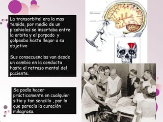 La transorbital era la mas
temida, por medio de un
picahielos se insertaba entre
la orbita y el parpado y
golpeaba hasta llegar a su
objetivo
Sus consecuencias van desde
un cambio en la conducta
hasta el retraso mental del
paciente.
Se podía hacer
prácticamente en cualquier
sitio y tan sencillo , por lo
que parecía la curación
milagrosa.
 