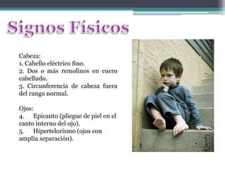 Cabeza:
1. Cabello eléctrico fino.
2. Dos o más remolinos en cuero
cabelludo.
3. Circunferencia de cabeza fuera
del rango normal.

Ojos:
4. Epicanto (pliegue de piel en el
canto interno del ojo).
5. Hipertelorismo (ojos con
amplia separación).
 