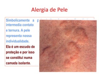 Alergia de Pele
Simbolicamente a pele indica fronteira, fixa limites,
intermedia contato
e ternura. A pele
representa nossa
individualidade.
Ela é um escudo de
proteção e por isso
se constitui numa
camada isolante.
 