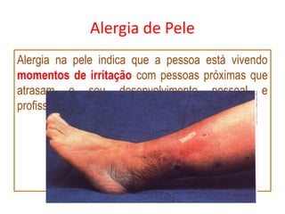 Alergia de Pele
Alergia na pele indica que a pessoa está vivendo
momentos de irritação com pessoas próximas que
atrasam o seu desenvolvimento pessoal e
profissional.
 