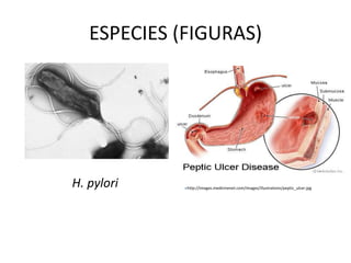 ESPECIES (FIGURAS)
http://images.medicinenet.com/images/illustrations/peptic_ulcer.jpg
H. pylori