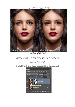 ‫اﻟﺸﻌﺮ‬ ‫اﺳﺘﺒﻌﺎد‬ ‫أﯾﻀﺎ‬ ‫ﻧﺤﻦ‬ ‫	:اﻟﻤﺜﺎل‬
	
‫اﻟﻌﯿﻮب‬ ‫ﻣﻦ‬ ‫اﻟﻨﮭﺎﺋﻲ‬ ‫ﺗﻨﻤﯿﻖ‬
‫اﻟﻤﺮﺷﺢ‬ ‫ﻗﺒﻞ‬ ‫ﻣﻦ‬ ‫إزاﻟﺘﮭﺎ‬ ‫ﯾﻤﻜﻦ‬ ‫ﻻ‬ ‫اﻟﺘﻲ‬ ‫اﻟﻌﯿﻮب‬ ‫ﺑﻌﺾ‬‫ﯾﺪوﯾﺎ‬ ‫إزاﻟﺔ‬ ‫وﯾﺠﺐ‬ .
‫ﯾﺪوﯾﺎ‬ ‫اﻟﻌﯿﻮب‬ ‫ھﺬه‬ ‫:ﻹزاﻟﺔ‬
1. ‫اﻟﻄﺒﻘﺎت‬ ‫ﻟﻮﺣﺔ‬ ‫ﻓﻲ‬ ‫اﻟﻤﺼﻐﺮات‬ ‫ﺑﺎﻟﻀﻐﻂ‬ (‫ﻗﻨﺎع‬ ‫ﻣﻦ‬ ‫)ﺑﺪﻻ‬ ‫طﺒﻘﺔ‬ ‫	:ﺗﻔﻌﯿﻞ‬
	
 