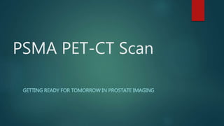 PSMA PET-CT Scan
GETTING READY FOR TOMORROW IN PROSTATE IMAGING
 