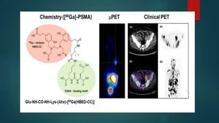 PSMA pet ct scan | PPTX