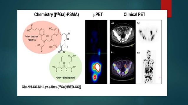 PSMA pet ct scan | PPT