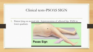 Psoas Sign