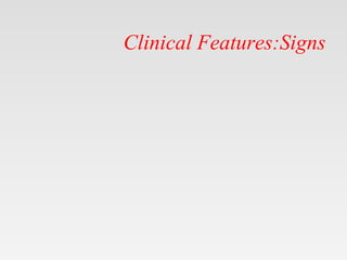 Clinical Features:Signs
 