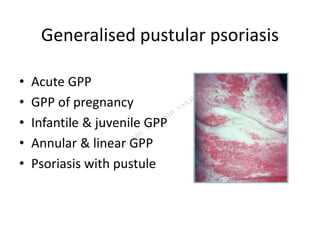 Generalised pustular psoriasis
• Acute GPP
• GPP of pregnancy
• Infantile & juvenile GPP
• Annular & linear GPP
• Psoriasis with pustule
 